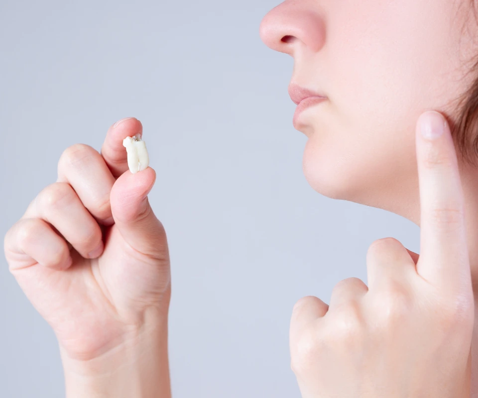 Emergency-Wisdom-Tooth-Extraction-Little-Rock-AR