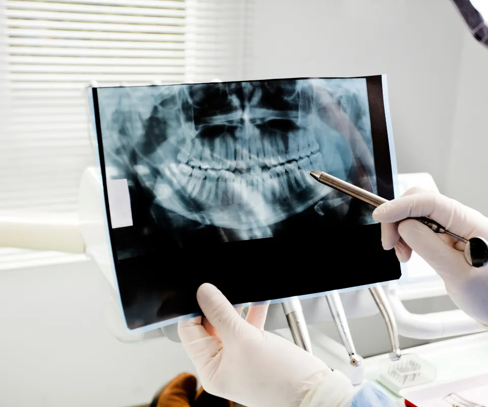 Emergency-dental-X-rays-Little-Rock-AR