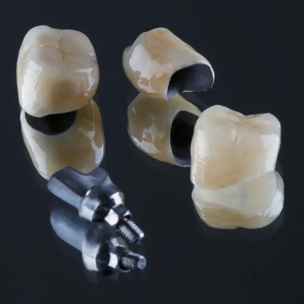 Loose-dental-bridge-or-crown-Little-Rock-AR