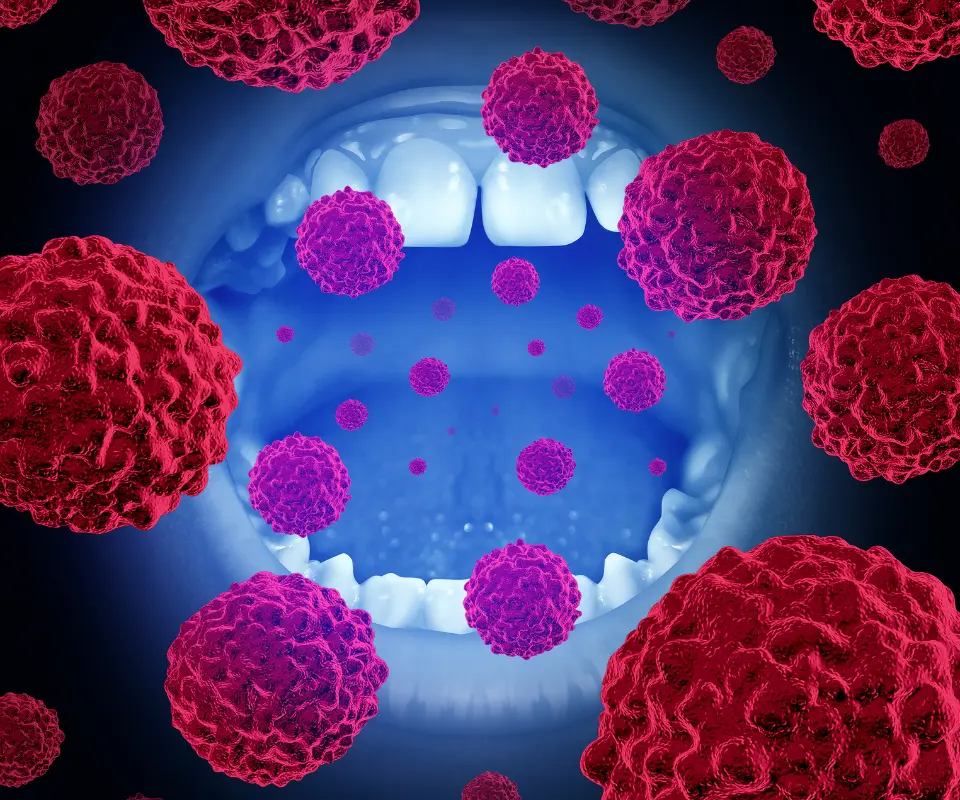 Oral-Cancer-Little-Rock-AR
