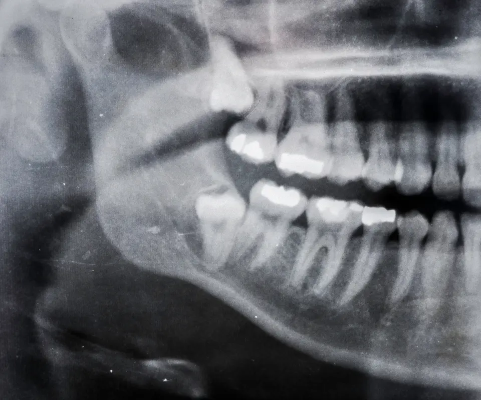 Quick-Exam-and-Xray-Little-Rock-AR