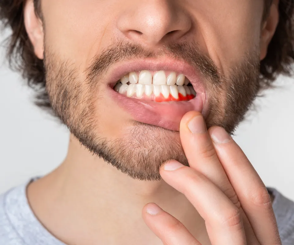 When-to-See-an-Emergency-Dentist-for-a-Tooth-Infection-Little-Rock-AR