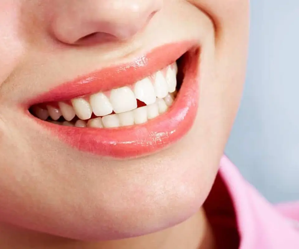 Chipped-Teeth-Little-Rock-AR