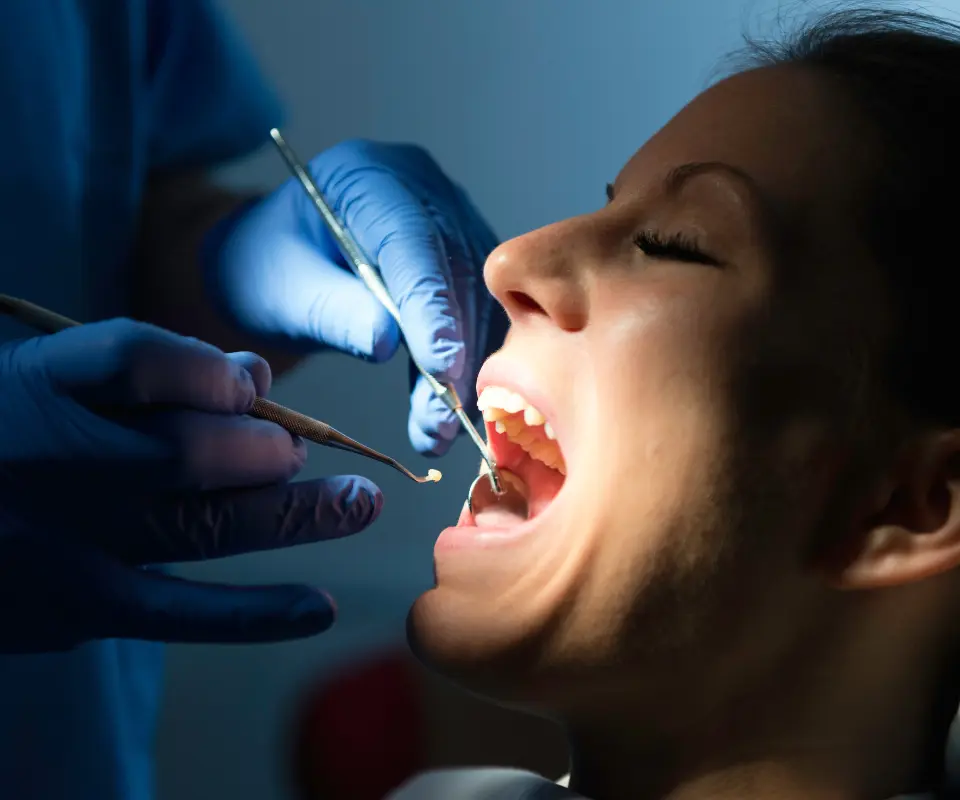 Lost-Fillings-or-Crowns-Little-Rock-AR