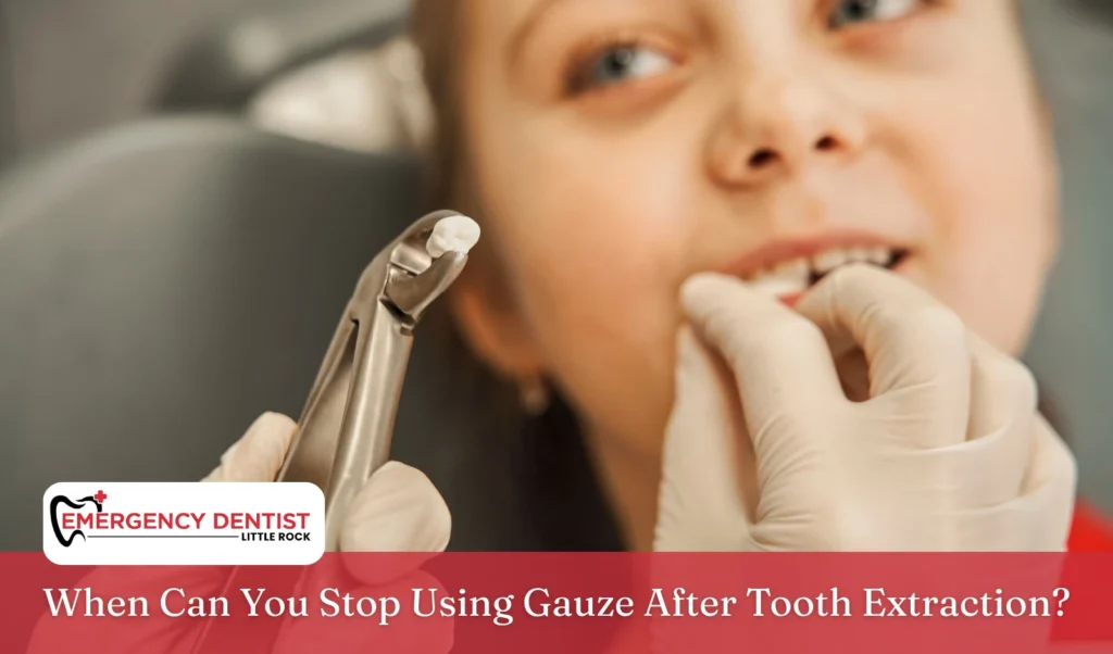 when-stop-gauze-after-extraction