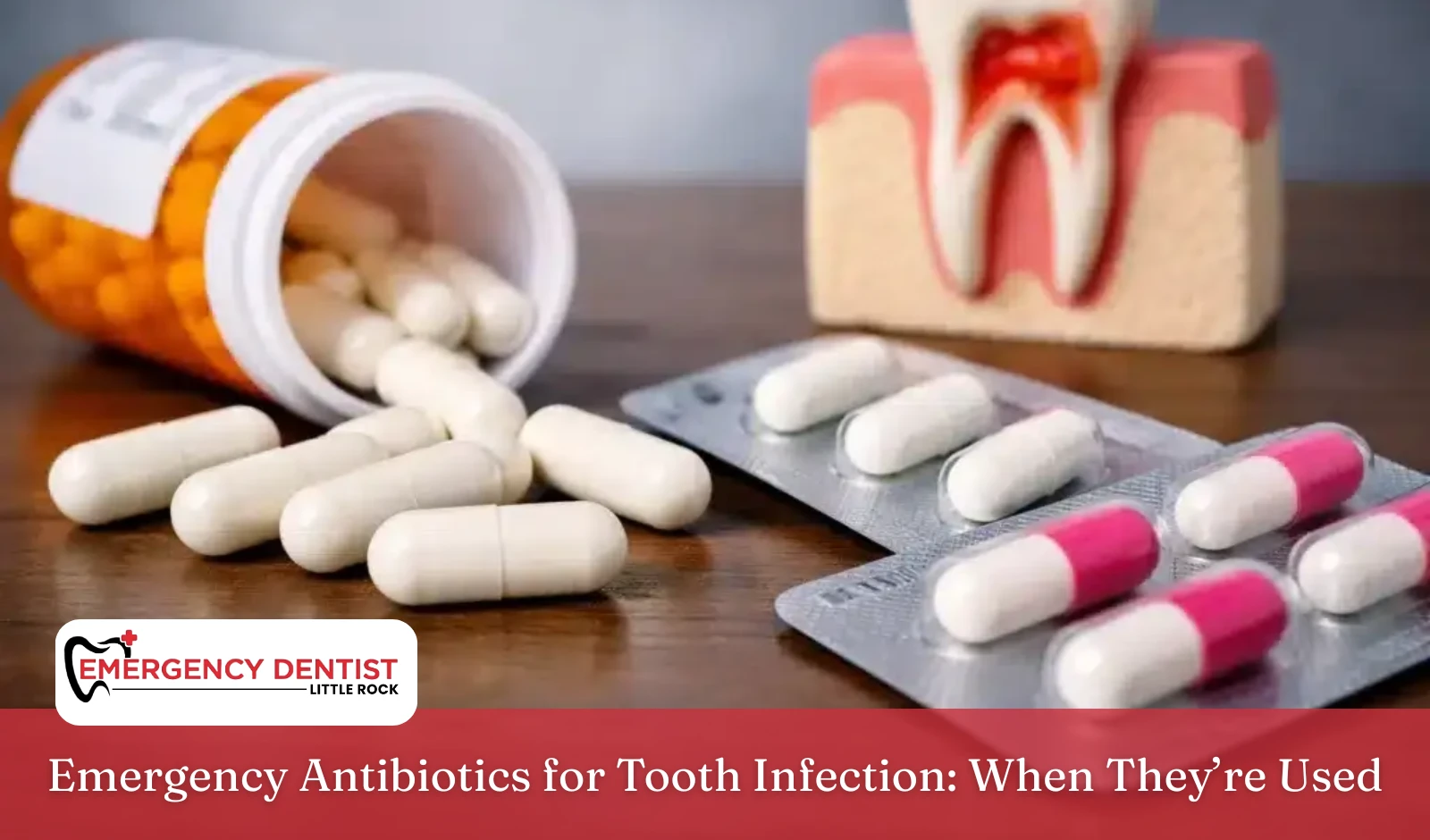 emergency-antibiotics-tooth-infection-when-used