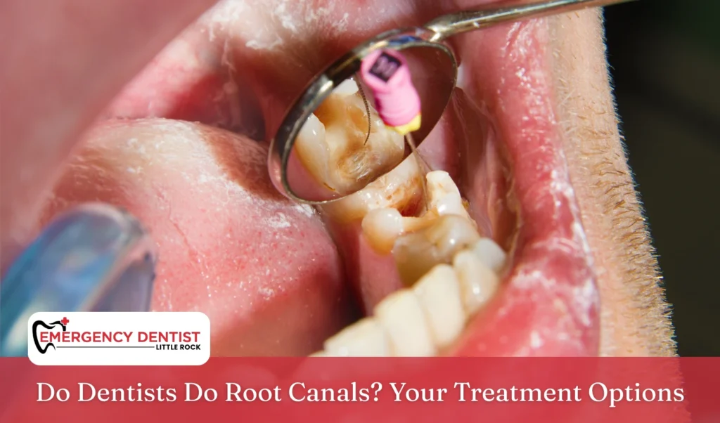 do-dentists-do-root-canals-treatment-options