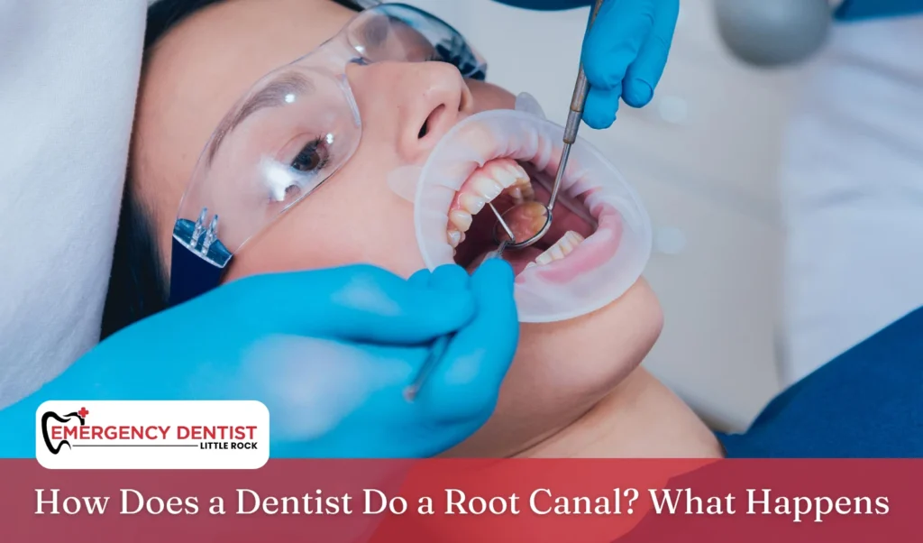 how-does-a-dentist-do-a-root-canal