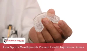 How Sports Mouthguards Prevent Dental Injuries in Games