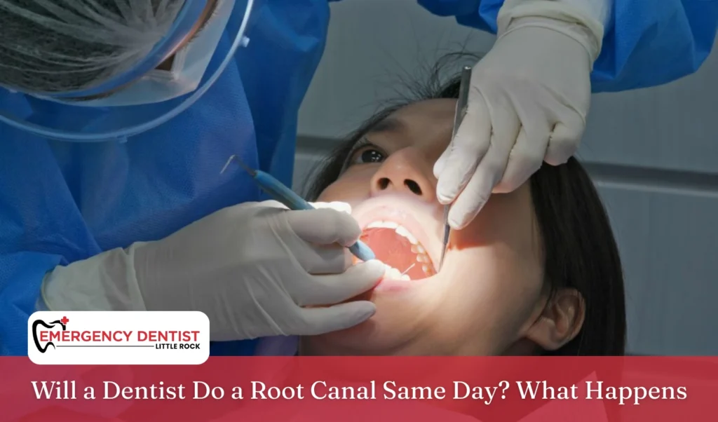 will-a-dentist-do-a-root-canal-same-day
