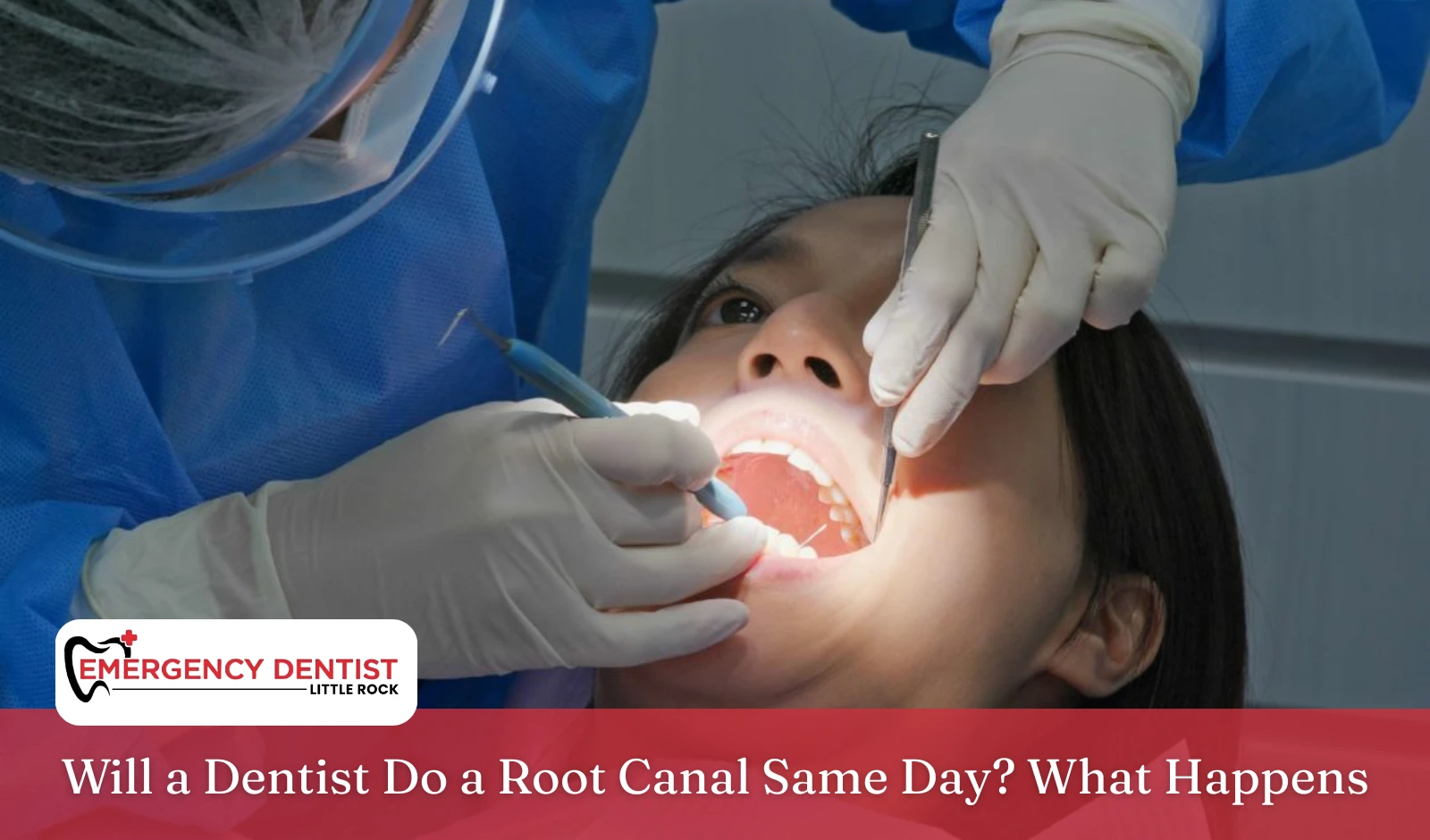 will-a-dentist-do-a-root-canal-same-day