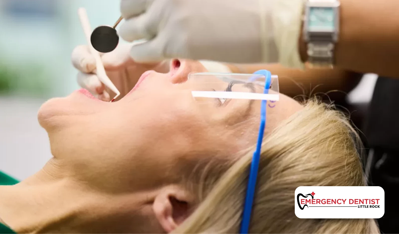Will You Be Awake During Root Canal Treatment